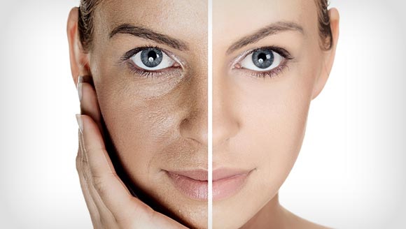 facial-rejuvenation image