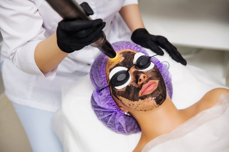 Carbon Laser Facial image